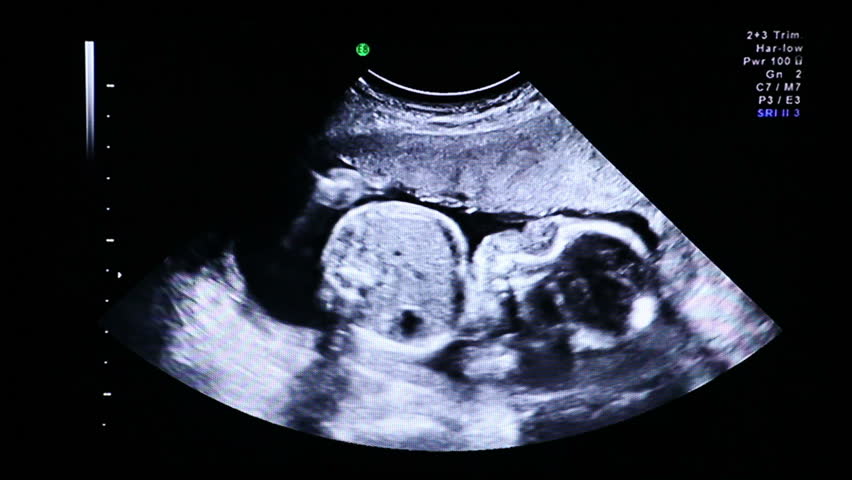 Ultrasound ecography. Gynecological medical examination. 22 weeks old pregnancy. 4D preparations and transition to. 