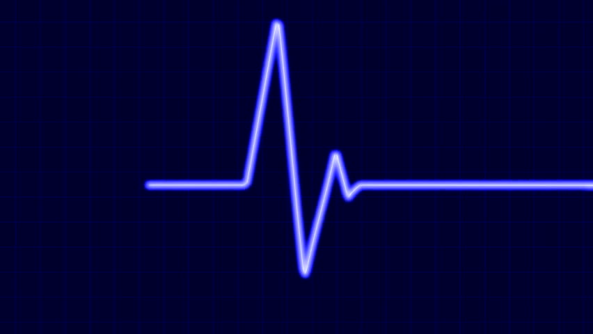 Cardiogram. Six seconds loop.