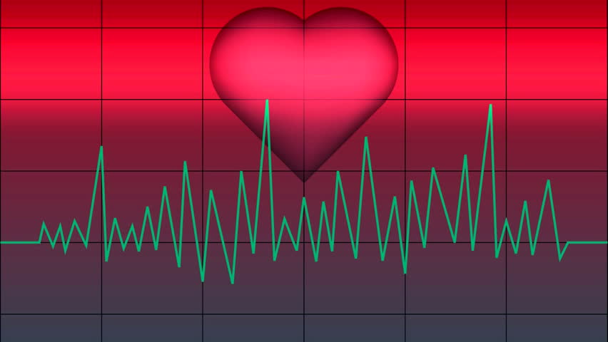 Abstract heart monitor effect starting fast, slowing down, then going to static. HD 1080i