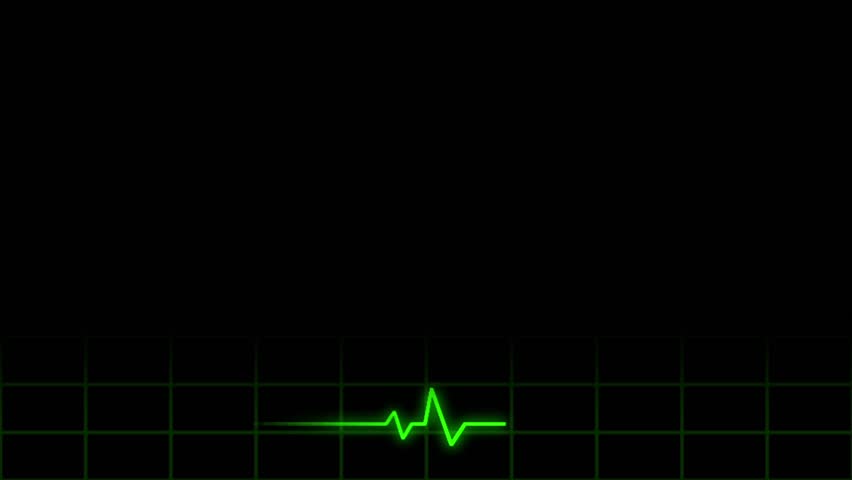Seamless lower third loop of an electronic display measuring heart beat and rate. Top portion is black and very text-friendly. HD.