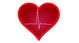 EKG heart monitor