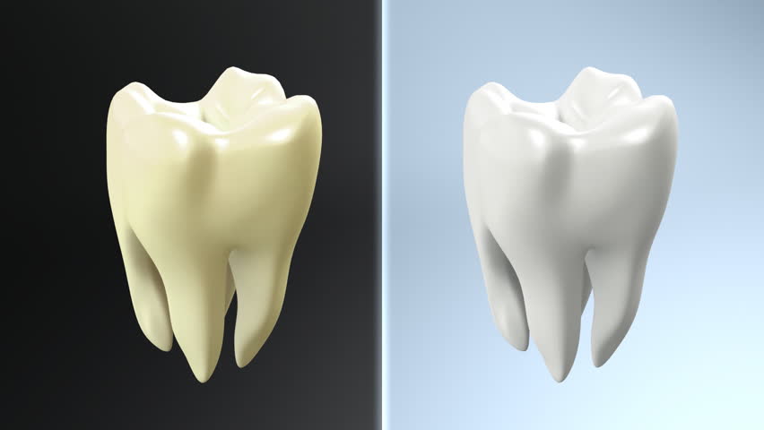  The health of tooth and bad tooth comparison for tooth care concept.