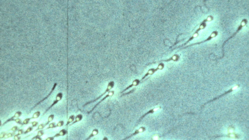Microscopic Sperm Footage 6