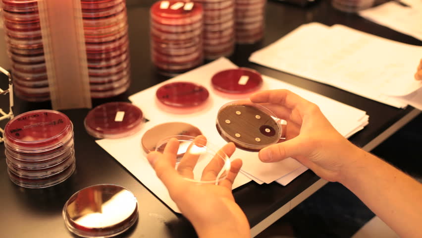 researcher looks at a petri dish full of infections
