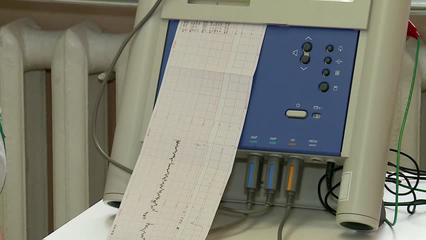 Fetal monitoring diagram of pregnant woman. (heartbeat Fetal Monitoring)