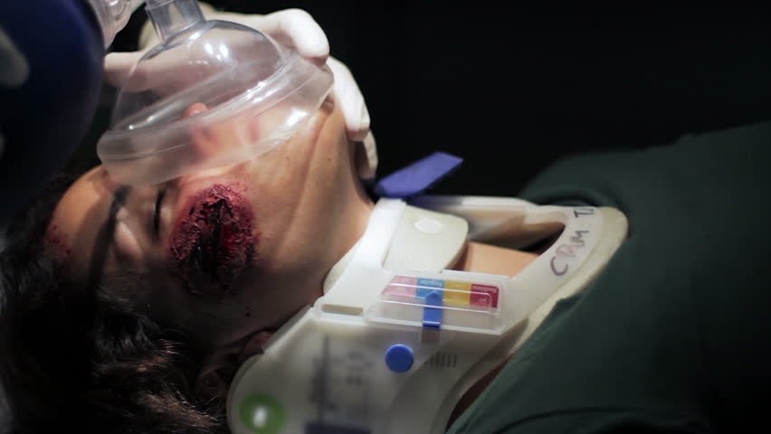 An hispanic patient on the hospital severely injured with artificial ventilator