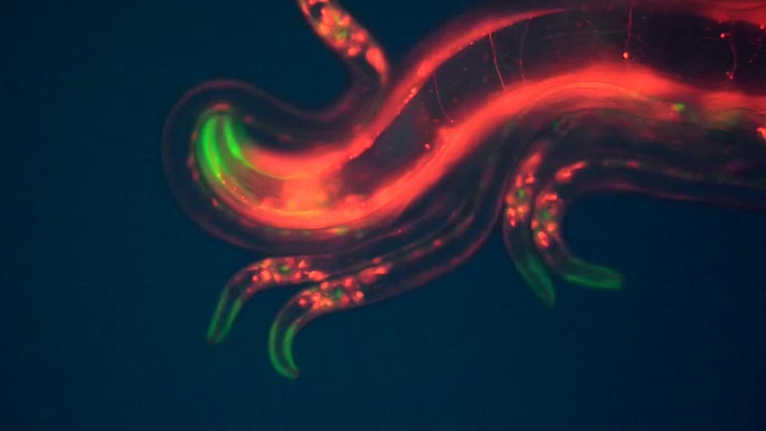 Caenorhabditis elegans, a free-living transparent nematode (roundworm), about 1 mm in length.
