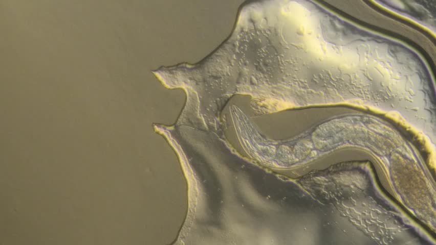 Caenorhabditis elegans, a free-living transparent nematode (roundworm), about 1 mm in length.