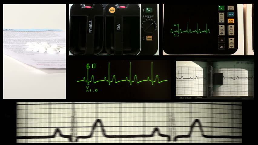 EKG Medical Emergency Montage - HD