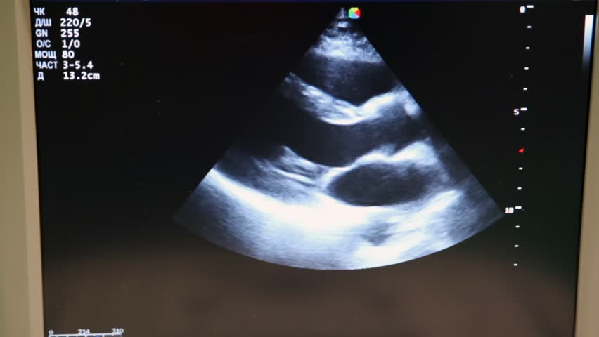 monitor of ultrasonic diagnostics of internal with indications close up 