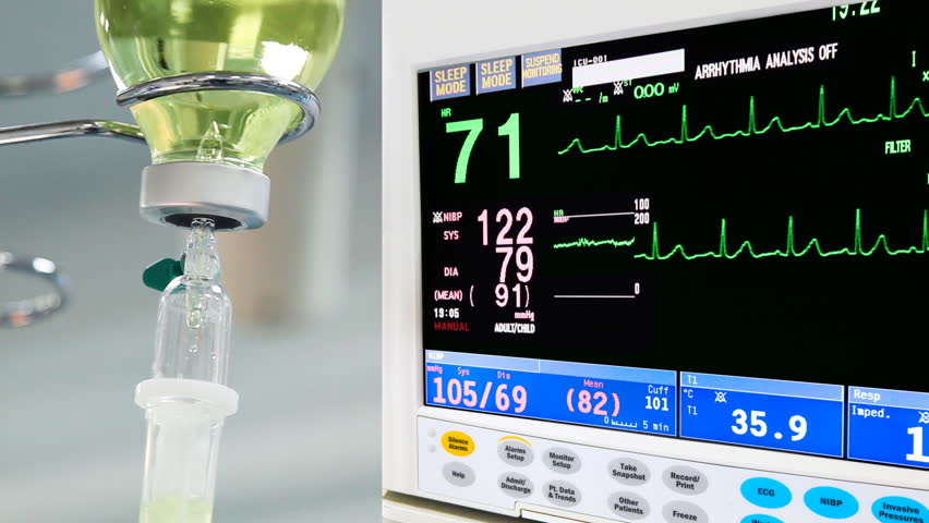 intravenous drip with ECG monitor in operation room