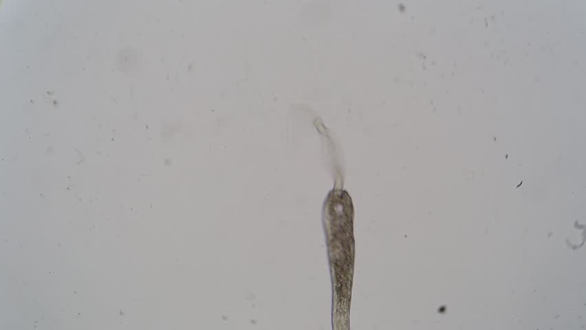 Header of trematode