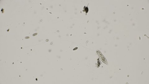 paramecium caudatum slide