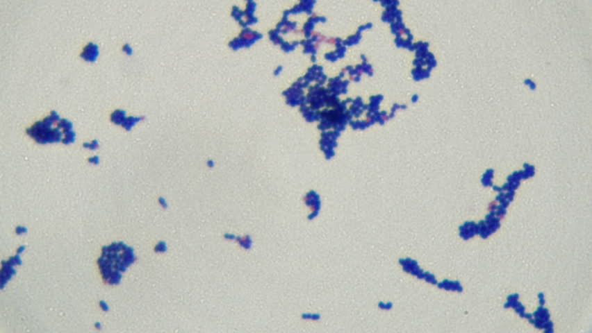 Lactobacillus Under Microscope 1000x - Micropedia