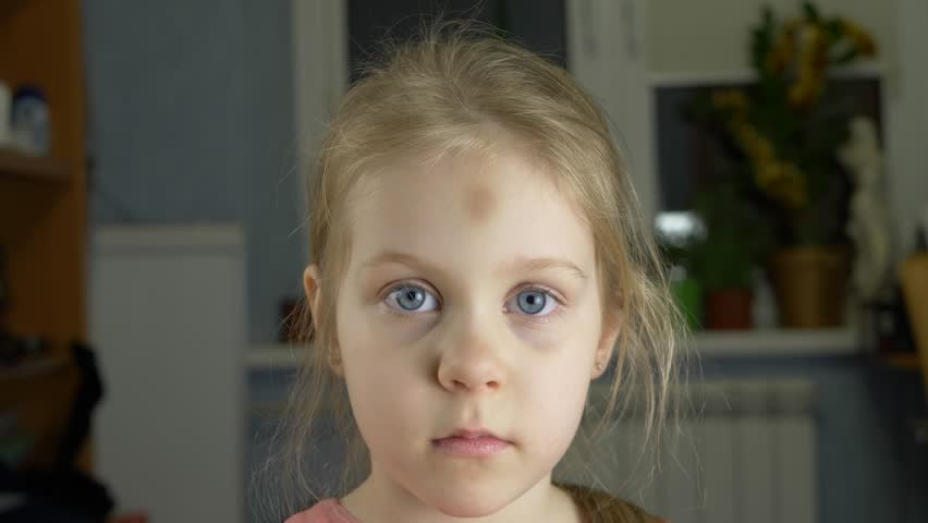 Little Blue Eyed Girl Child Rubbin Stock Footage Video 100