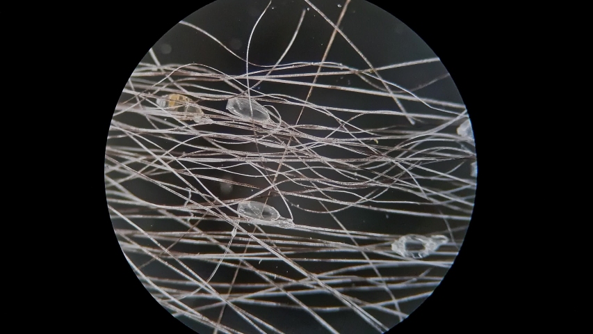 1000 Lice Shampoo Hair Stock Video Clips And Footage Royalty