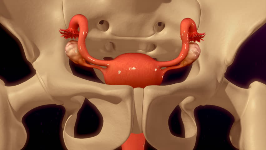 Header of hysterectomy