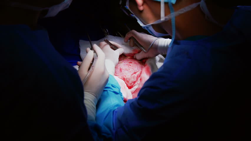 Header of craniotomy