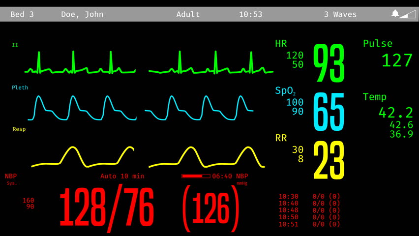 Monitoring Of Patient's Condition, Vital Signs On ICU Monitor In ...