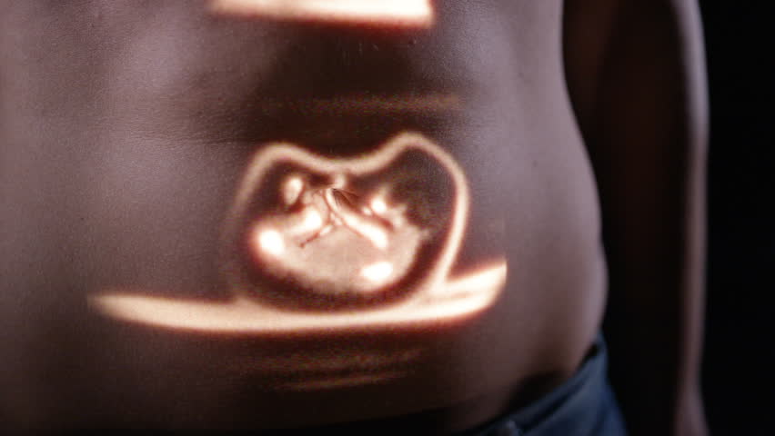 Header of foetus