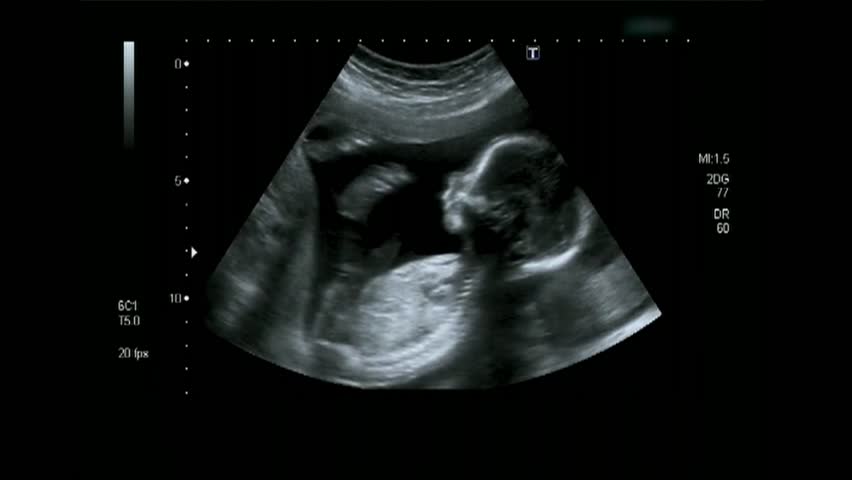 Ultrasound Stock Footage Video | Shutterstock