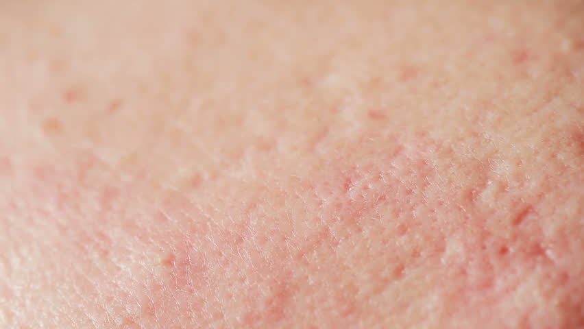 Header of dermatology