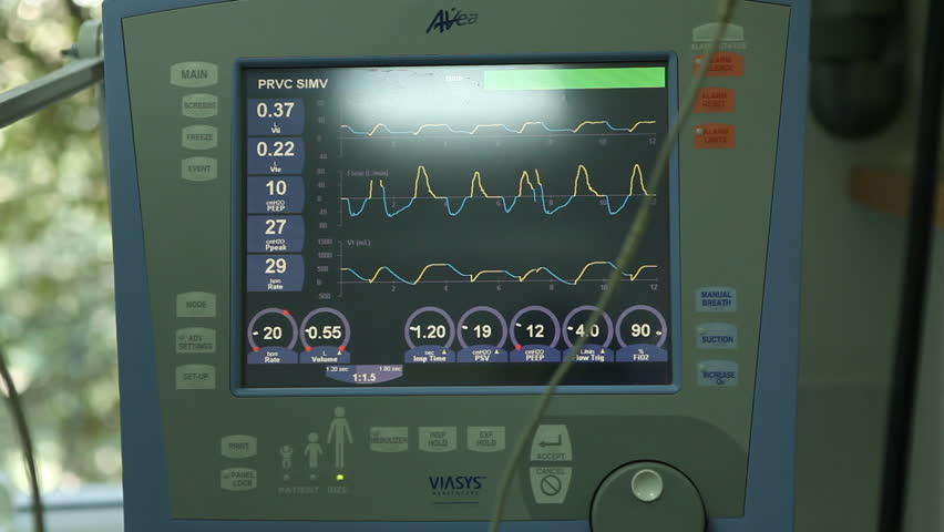 Ecg Monitor Patient's Condition In Operating Room,close Up Heartbeat On ...