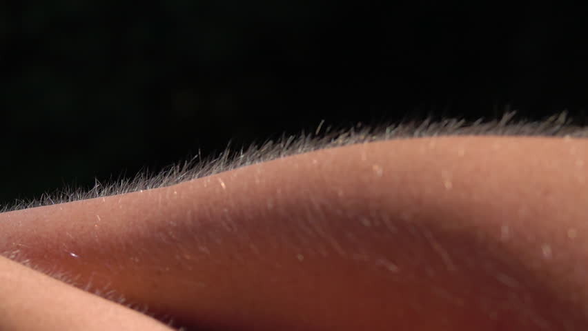 Detail Of Skin And Hair With Goose Bumps On