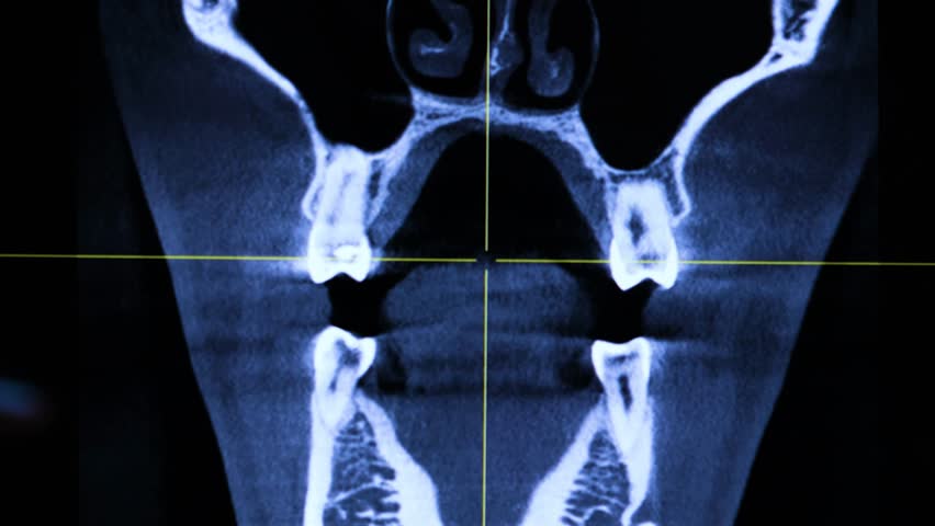 Header of symptom