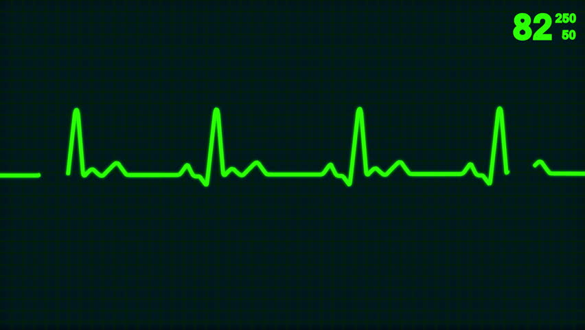 Animated Lifeline Stock Footage Video 3783236 | Shutterstock