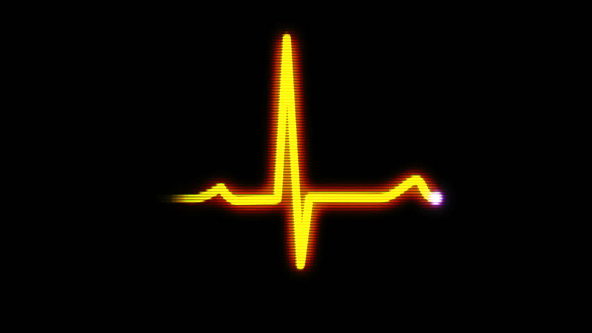 An animated 8-bit representation of a heart monitor EKG flatlines. With sound and luma matte.